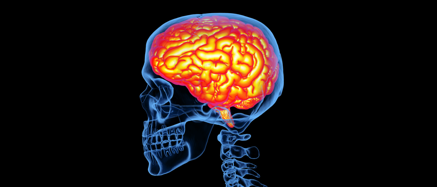 El problema de la enfermedad cerebrovascular: una revisión actualizada en AMF semFYC